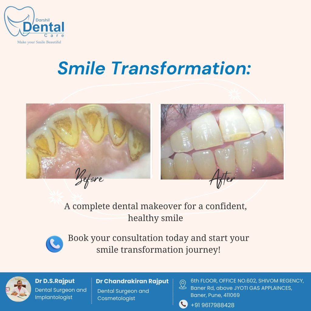 Dentiest in baner
