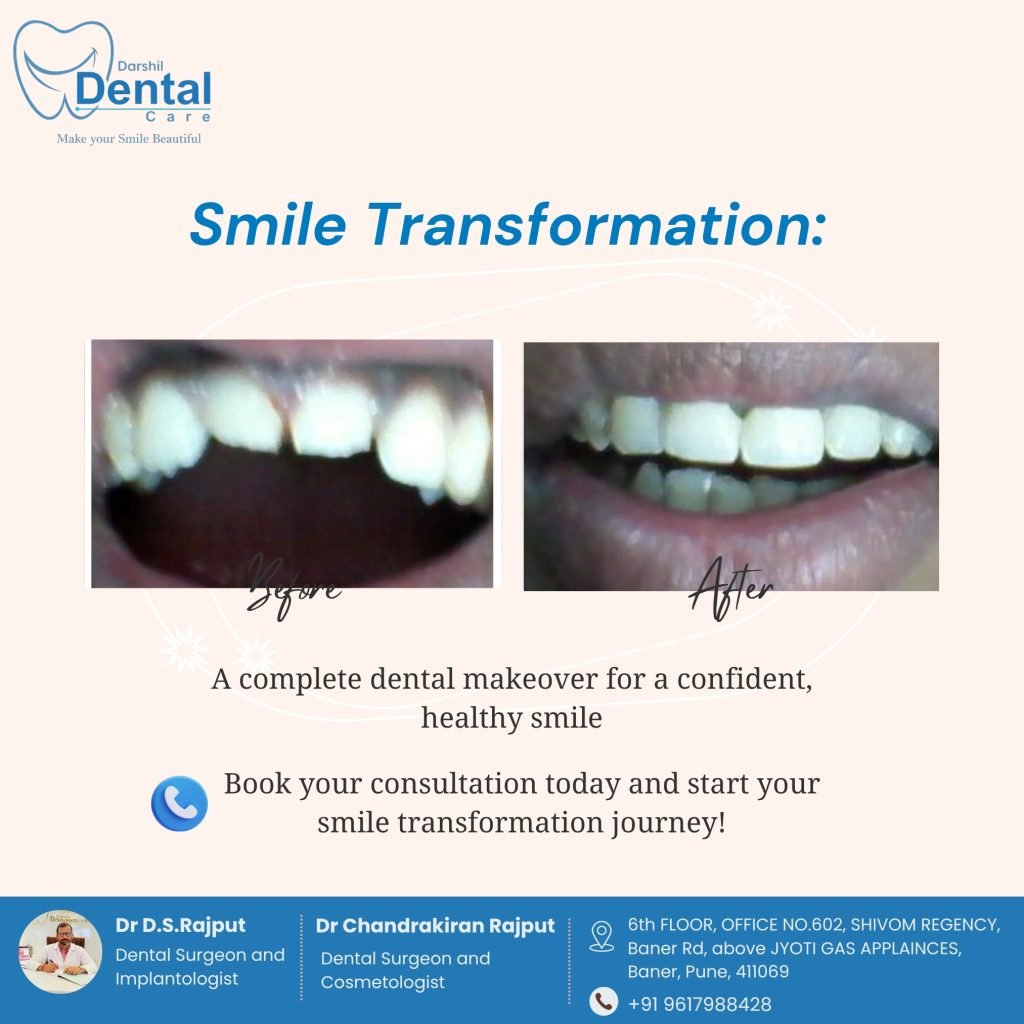 Best Dentiest in baner