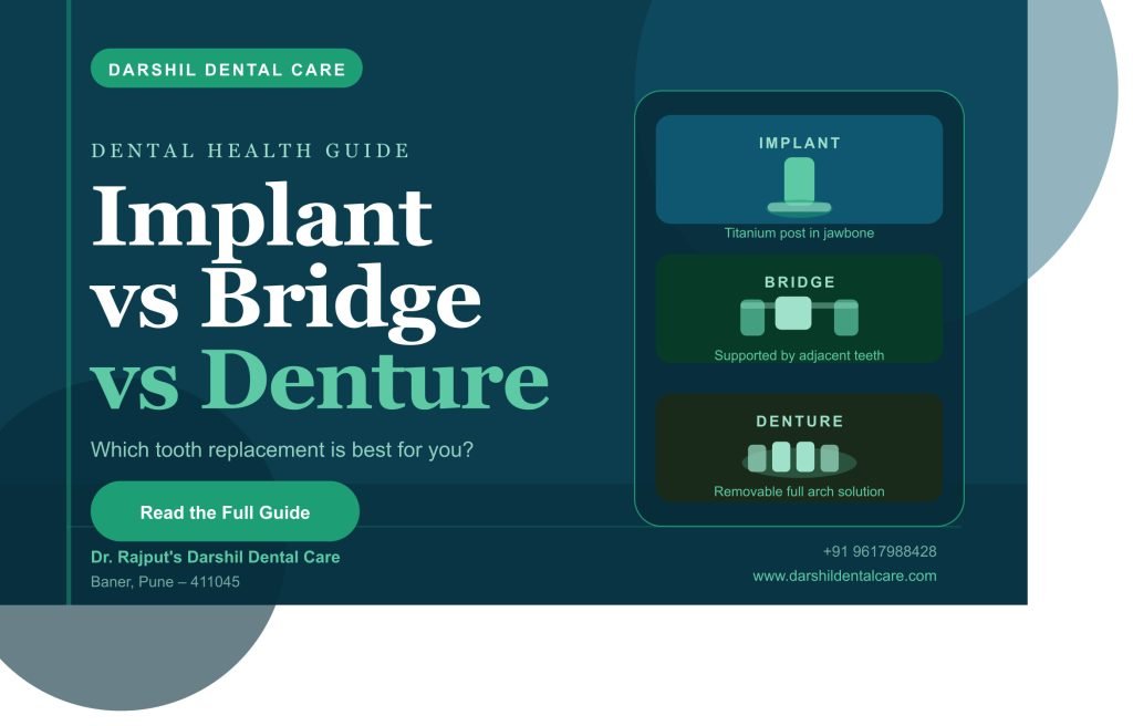 dental implant vs bridge vs denture