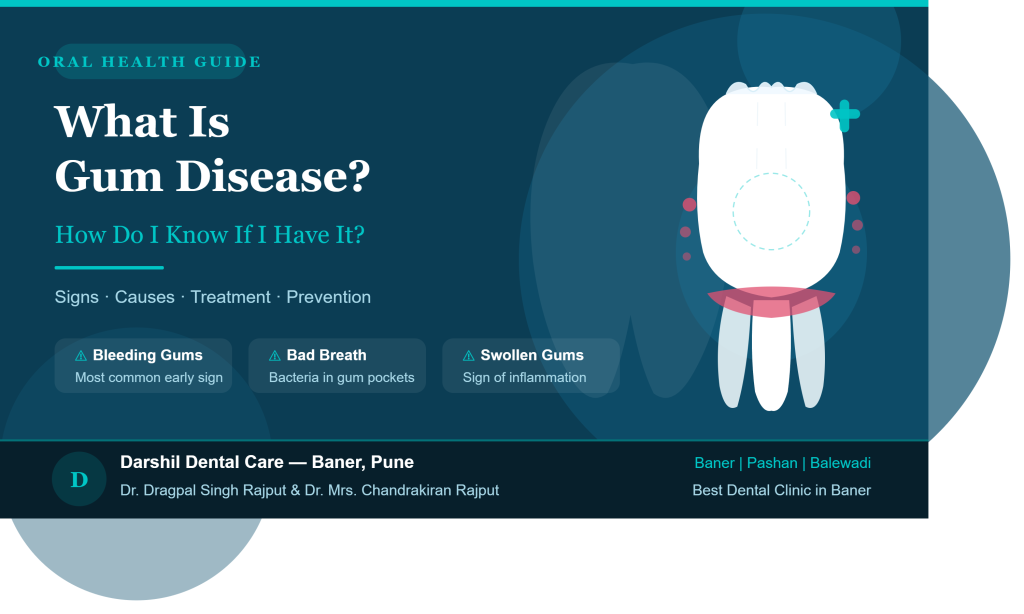 gum disease