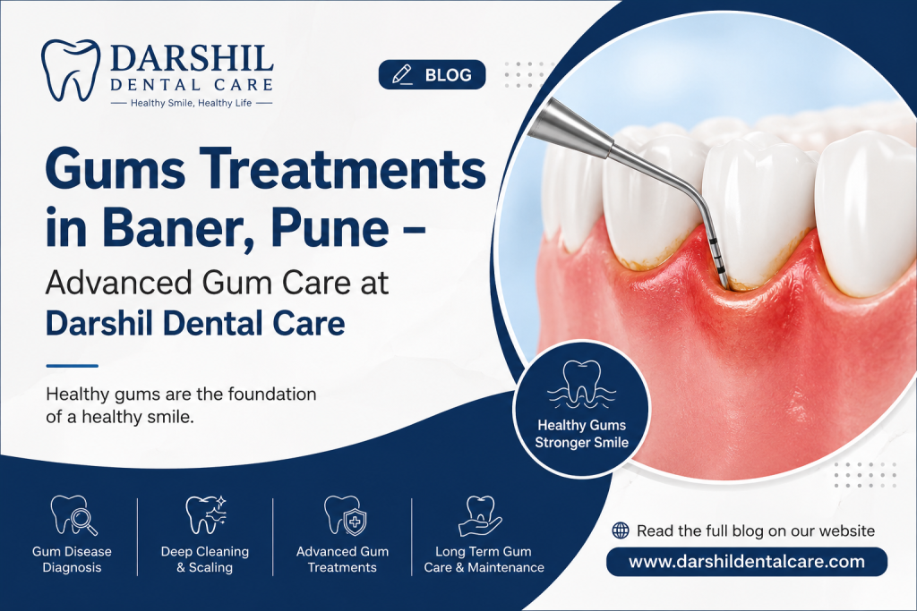 Gums Treatments in Baner, Pune – Advanced Gum Care at Darshil Dental Care