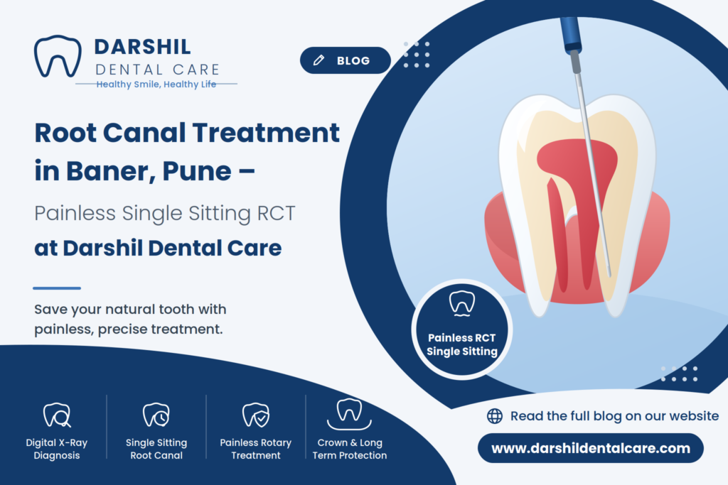 Root Canal Treatment in Baner