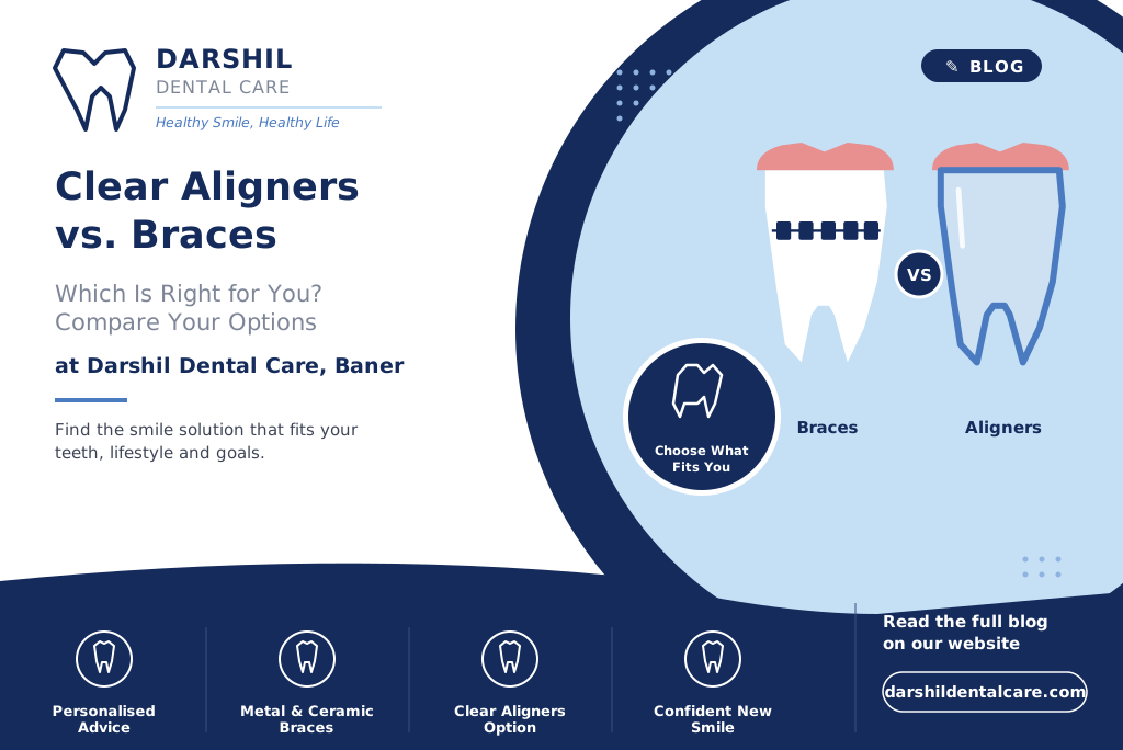 Aligners Vs Braces in Baner